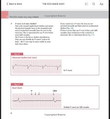 Sách ngoại văn The ECG Made Easy 9th