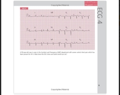 Sách ngoại văn 150 ECG Cases 5th