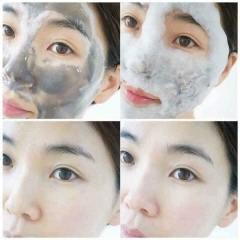 Set thải độc sum trắng 50kw (20ea)