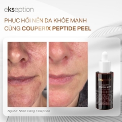 ekseption Couperix Peptide Peel - Phục Hồi Da Mỏng Yếu, Giãn Mao Mạch