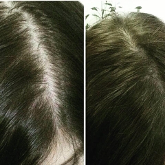 Kẹo Dẻo Vitamin Chăm Sóc Hỗ Trợ Mọc Tóc HairBurst Chewable Hair Vitamins 60 Viên