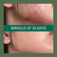 Kem Dưỡng Some By Mi AHA BHA PHA 30 Days Miracle Cream Hũ 60g