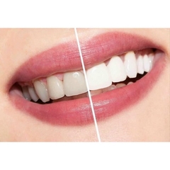 Nước Súc Miệng Crest Pro Trắng Răng  Thơm Miệng Advanced Complete Care Mỹ 1000ml