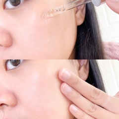 Serum Esthemax Vitamin C Serum 561 Trắng Sáng Da Cấp Ẩm Chống Lão Hóa Hàn Quốc Chai 100ml