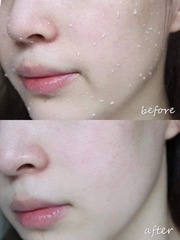 Tẩy TBC Cure Natural Aqua Gel Nhật Bản Chai 100g