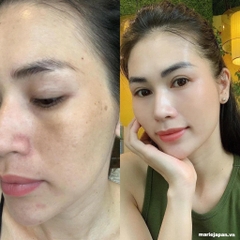 Kem Dưỡng Transino Nâng Tông Dưỡng Trắng Tái Tạo Da Whitening Repair Cream EX 35g Nhật Bản