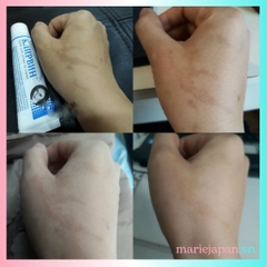 Kem Sẹo Nga Klirvin Giảm Thâm Mờ Sẹo Rạn Da Tuýp 25g