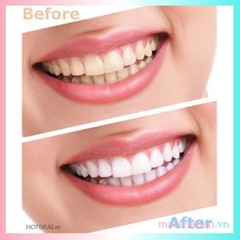 Nước Súc Miệng Propolinse Trắng Răng  Sạch Mảng Bám 600ml Nhật Bản