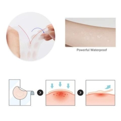 Miếng Dán Mụn Dr.G A'Clear Spot Cure Patch 39pcs Hàn Quốc