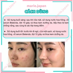 Serum Giảm Mụn Bielenda Sáng Da Se Lỗ Chân Lông Super Power Mezo Serum 30ml