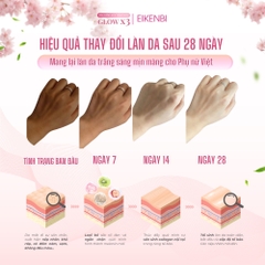 Kem Kích Trắng Body Nâng Tone Glow X3 Eikenbi 200gr