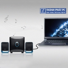 Cáp Audio 3.5mm to RCA dài 1,5m Ugreen 10583