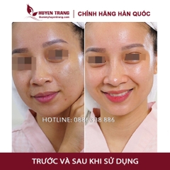 Tế Bào Gốc Hàn Quốc CUTISCURA Trắng Da (10ml/lọ) - Thẩm Mỹ Huyền Trang NANOCEE