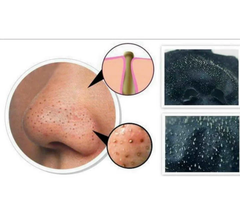 Gel lột mụn cám mũi Kose Tuýp 25g