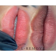 Dung Dịch Xóa Xăm L - Remove