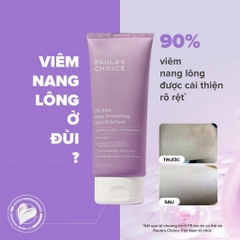 Kem Dưỡng Thể Paula's Choice Giảm Viêm Lỗ Chân Lông