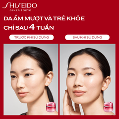 Kem dưỡng da của Shiseido Essential Energy Hydrating Cream 15ml