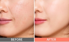 Kem nền Enprani Age Cover Lasting Veil Foundation