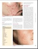 Sách Cosmetic Dermatology: Principles and Practice