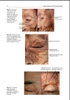 Sách Clinical Anatomy of the Face for Filler and Botulinum Toxin Injection