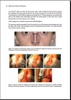 Sách Miniinvasive Techniques in Rhinoplasty ̣̣( Kỹ thuật Miniinvasive trong nâng mũi )