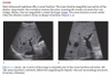 Sách ma and mateer's emergency ultrasound