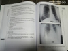 Sách phân tích hình ảnh X quang ngực từ A đến Z