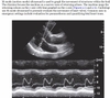 Sách ma and mateer's emergency ultrasound