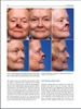 Sách  principles of Nasal Reconstruction