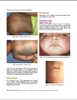 Sách Color Atlas and Synopsis of Pediatric Dermatology