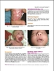 Sách Color Atlas and Synopsis of Pediatric Dermatology