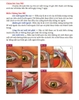 Sách Atlas Hướng Dẫn Tất Tần Tật Về Kỹ Thuật Phẫu Thuật Mắt Và Vùng Quanh Ổ Mắt