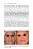 Sách handbook of Lasers in Dermatology