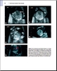 Sách twining's textbook of fetal abnormalities