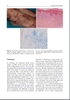 Sách Pigmentary Skin Disorders -Rối loạn sắc tố da