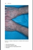 Sách handbook of Lasers in Dermatology