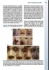 Sách   rhinoplasty  for the Asian Nose, An Issue of Facial Plastic Surgery  Clinics of North America