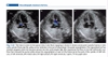 Sách echocardiographic anatomy in the fetus