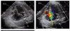 Sách echocardiographic anatomy in the fetus