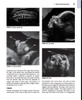 Sách twining's textbook of fetal abnormalities