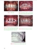 CHỈNH NHA CƠ BẢN TỪ NGUYÊN LÝ ĐẾN THỰC HÀNH