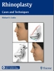 Sách  rhinoplasty : Cases and Techniques