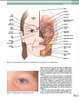 Sách Techniques in Ophthalmic Plastic Surgery: A Personal Tutorial