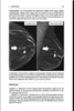 Sách digital breast tomosynthesis: a practical approach