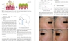 Sách botulinum Toxin for Asians-Springer Singapore (2017)