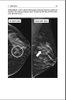 Sách digital breast tomosynthesis: a practical approach
