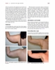 Sách body Contouring and Liposuction