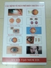 Tranh treo nhãn khoa các bệnh về mắt (KT 50 cm. 75 cm)