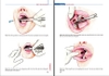 Sách thủ thuật tiểu phẫu trong da liễu thẩm mỹ