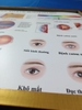 Tranh tráng gương nhãn khoa nội soi mắt và các bệnh lý của mắt(kích thước 50cm.75cm)